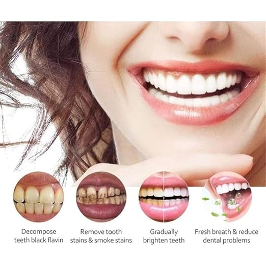 SP-4 Ultra Brightening Whitening Toothpaste (Pack of 2) – Removes Stains & Protects Enamel